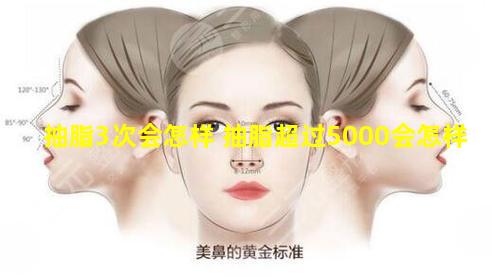 抽脂3次会怎样 抽脂超过5000会怎样